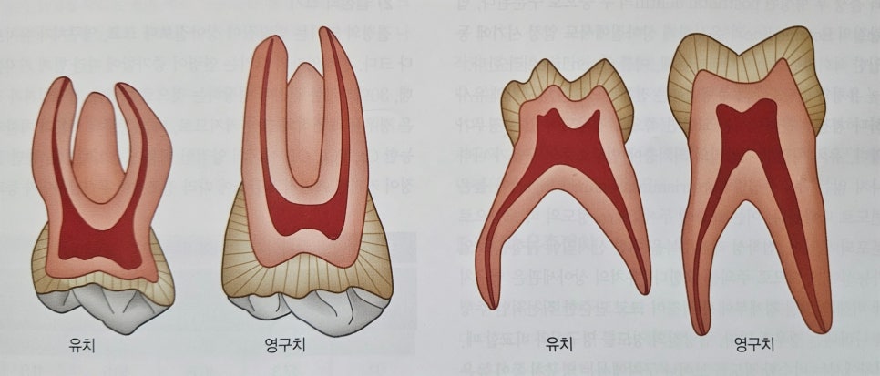 유치와 영구치의 단면 비교