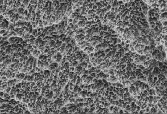 Smeets, Ralf, et al. "Impact of dental implant surface modifications on osseointegration." BioMed Research International 2016 (2016).