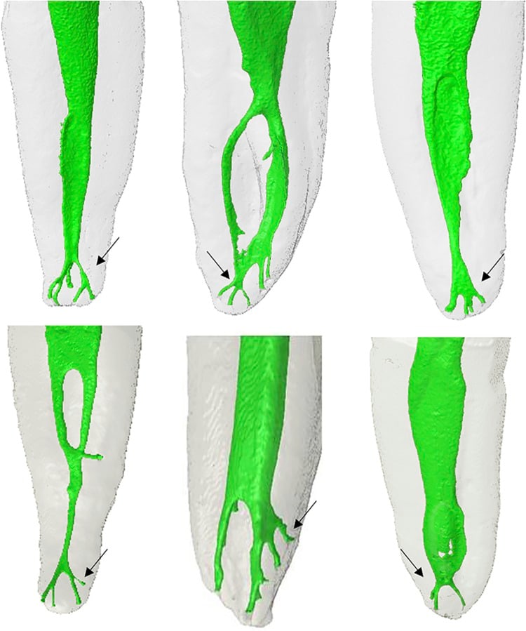 micro-CT로 본 실제 신경관의 3D 구조
