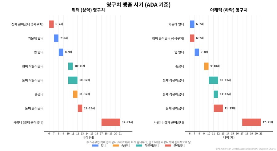 영구치가 나오는 시기 — 6세와 12세 무렵이 실란트 적기